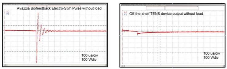 Why Avazzia Works - How TENS technology works, and why Avazzia works better